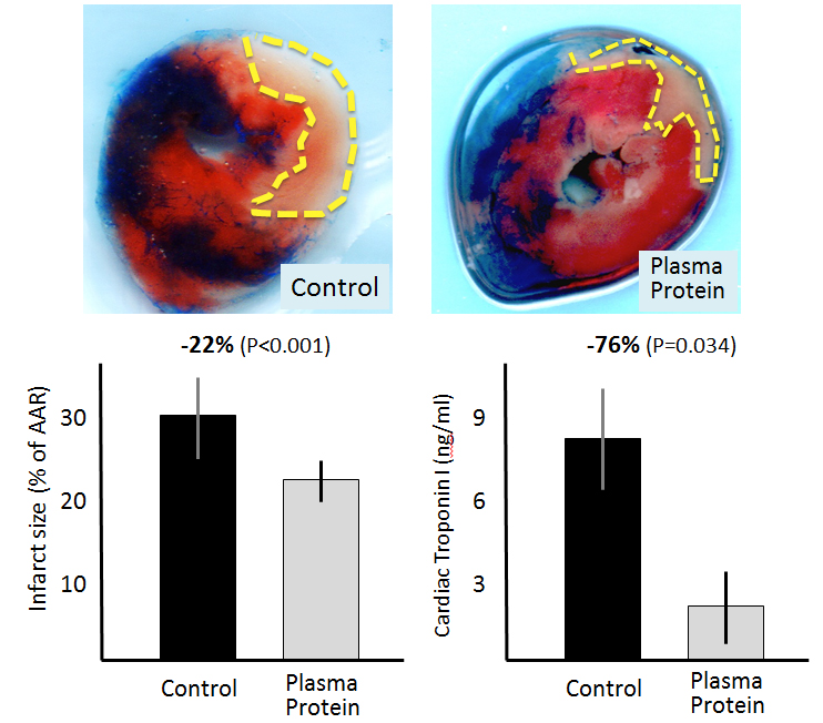 Two pictures showing Infarction size with Control and Plasma protein