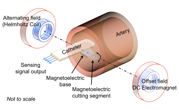 A conceptual illustration of the magnetoelectric device as a surgical catheter removing plaque from an artery